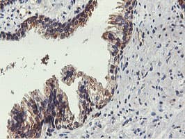 Monoclonal Mouse anti-Human FDFT1 / Squalene Synthase Antibody (clone OTI2F10, IHC, IF, WB)