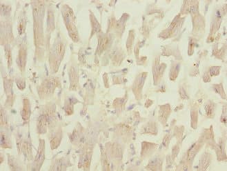 Polyclonal Rabbit anti-Human NDUFS3 Antibody (IHC, IF, WB)