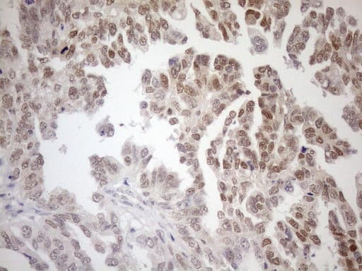 MGMT Antibody (clone OTI2E2)