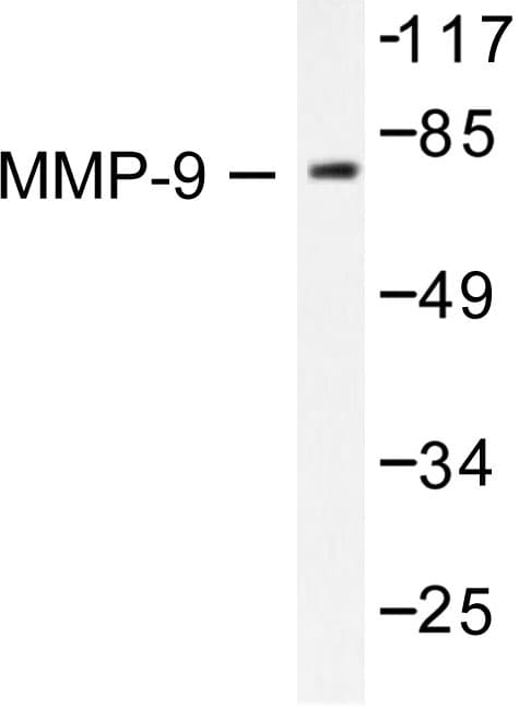 MMP9 / Gelatinase B Antibody (Trp680)