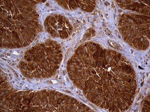 TRXR1 / TXNRD1 Antibody (clone OTI7B2, Carrier-free)