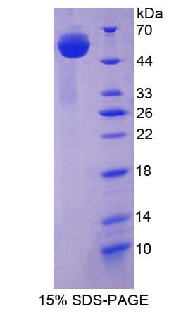 Human HAP1 Protein (Recombinant His-GST)