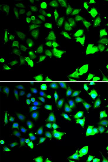 Polyclonal Rabbit anti-Human XIAP Antibody (IHC, IF, WB)