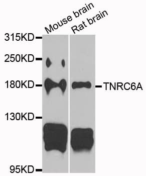 TNRC6A / GW182 Antibody