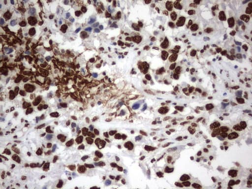 MLF1 Antibody (clone UMAB138)