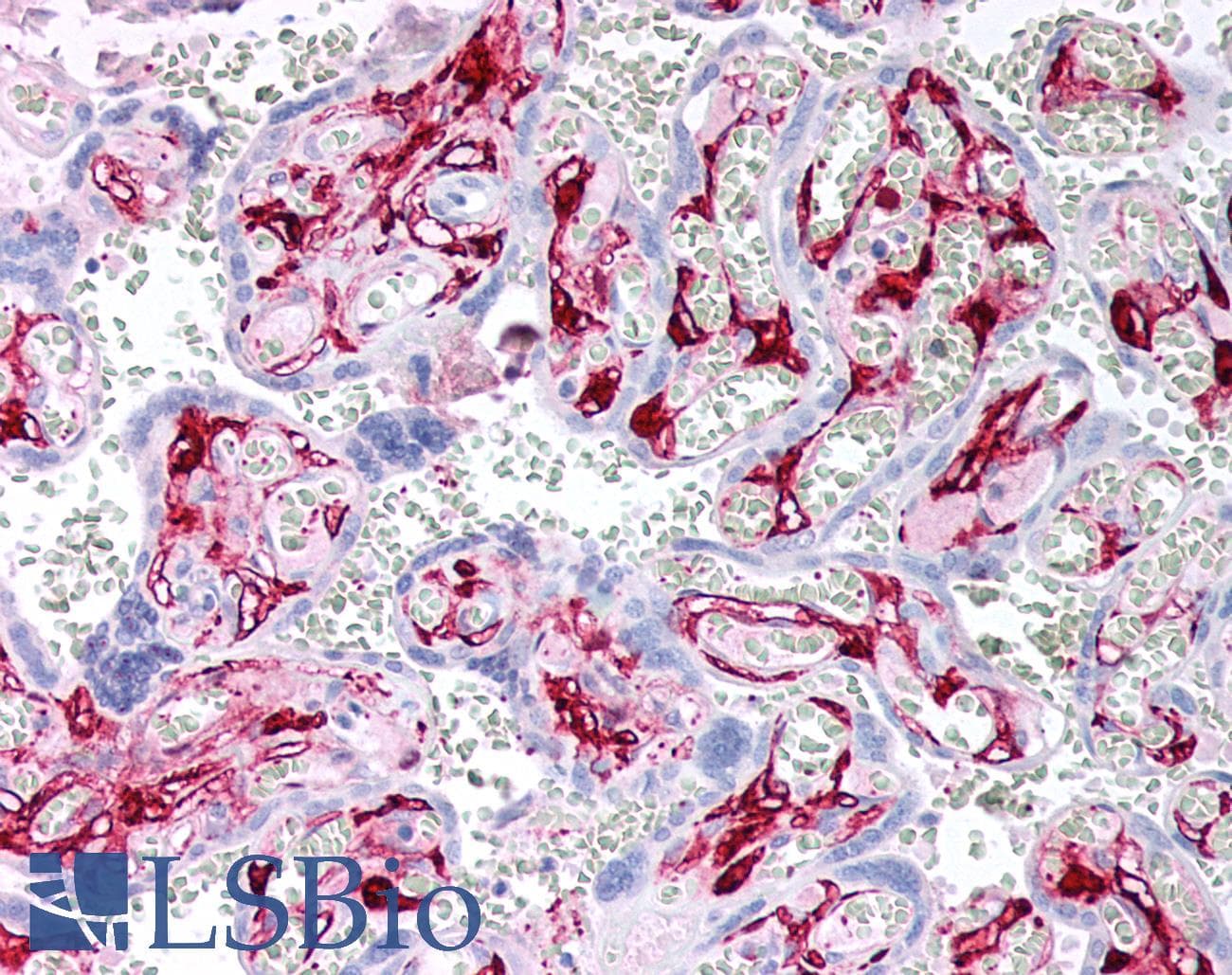 PathPlus™ Monoclonal Mouse anti-Human F13A1 / Factor XIIIa Antibody (IHC)