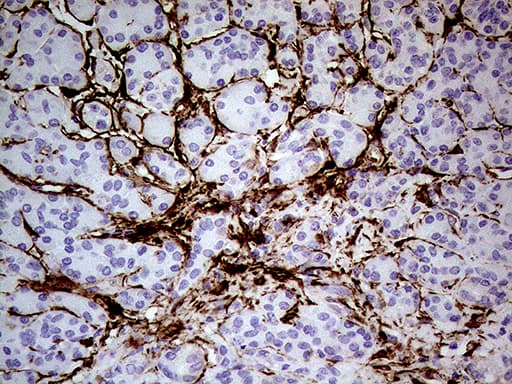 Monoclonal Mouse anti-Human TGM2 / Transglutaminase 2 Antibody (clone OTI1A3, IHC, WB)