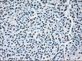 BRAF / B-Raf Antibody (clone OTI1G8)