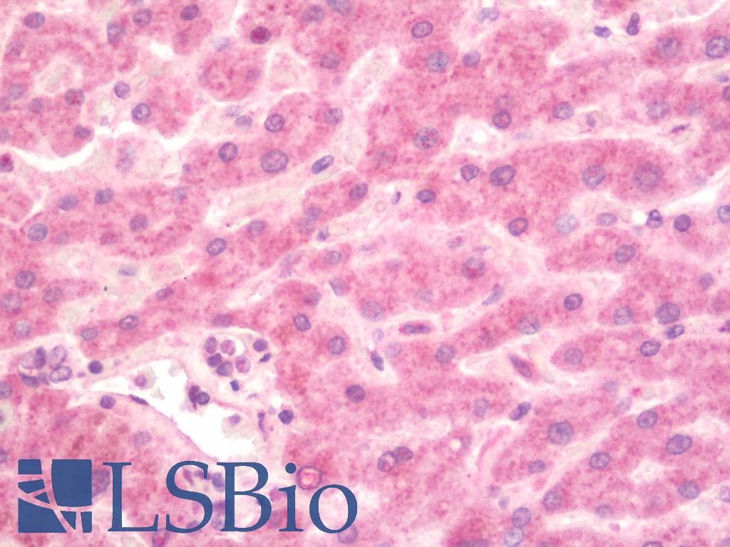CCL2 / MCP1 Antibody (HRP)