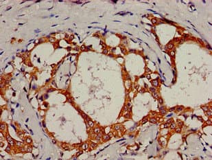 KRT18 / CK18 / Cytokeratin 18 Antibody