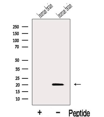 IFT27 / RABL4 Antibody