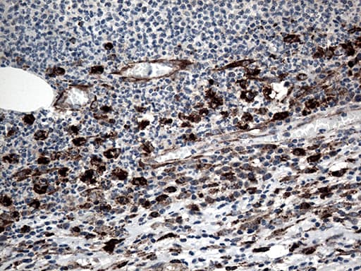 Monoclonal Mouse anti-Human CTSL / Cathepsin L Antibody (clone OTI6D5, aa114-333, IHC, WB)