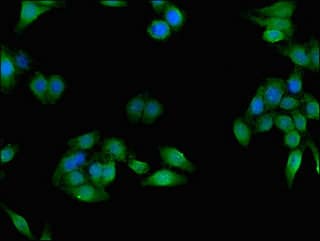 Carboxylesterase 1 / CES1 Antibody