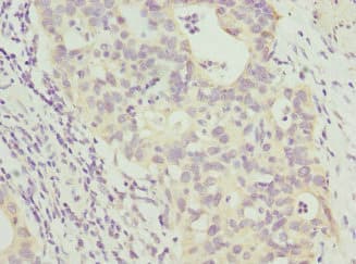 Polyclonal Rabbit anti-Human ANAPC2 / APC2 Antibody (IHC)