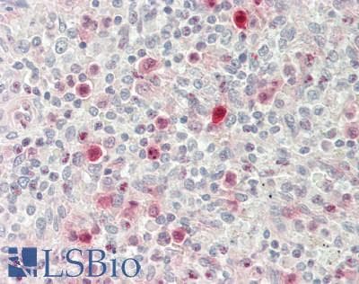 IHC-plus™ Polyclonal Rabbit anti-Human JAGN1 Antibody (IHC, WB)