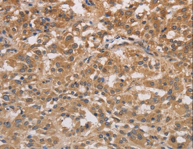 Polyclonal Rabbit anti-Human DSTN / Destrin Antibody (IHC)