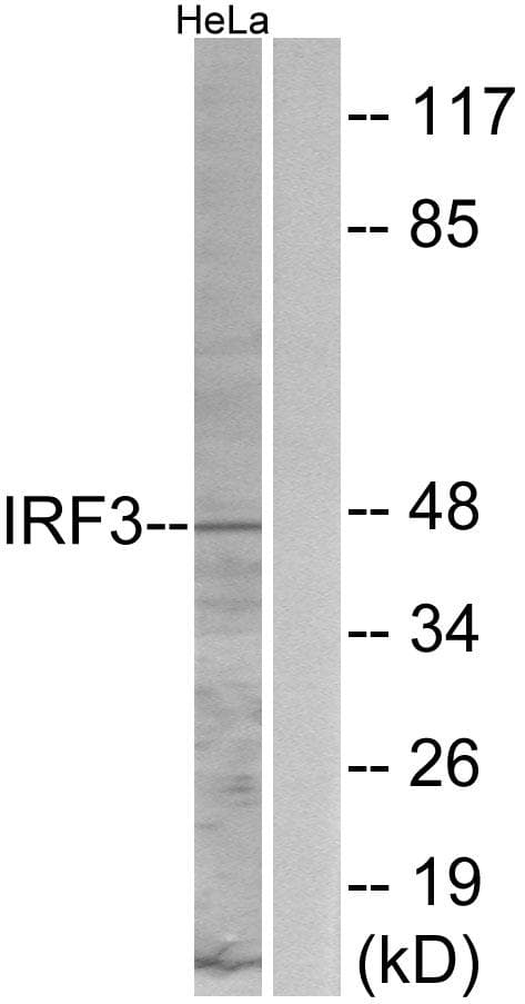 IRF3 Antibody (p396)