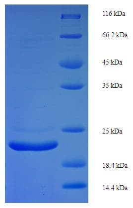 Mouse FGF21 Protein (Recombinant His)