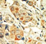 PRKCA / PKC-Alpha Antibody (aa299-329)