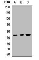 Polyclonal Rabbit anti-Human KDM8 / JMJD5 / FLJ13798 Antibody (WB)