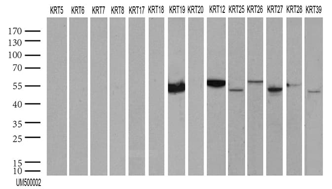 KRT19 / CK19 / Cytokeratin 19 Antibody (aa240-390, clone UMAB2)