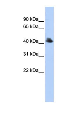 FBXO4 / FBX4 Antibody (C-Terminus)