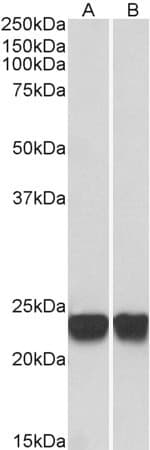 IHC-plus™ PARK7 / DJ-1 Antibody (aa178-189)