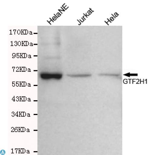 TFB1 / GTF2H1 Antibody