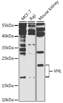 VHL / Von Hippel Lindau Antibody