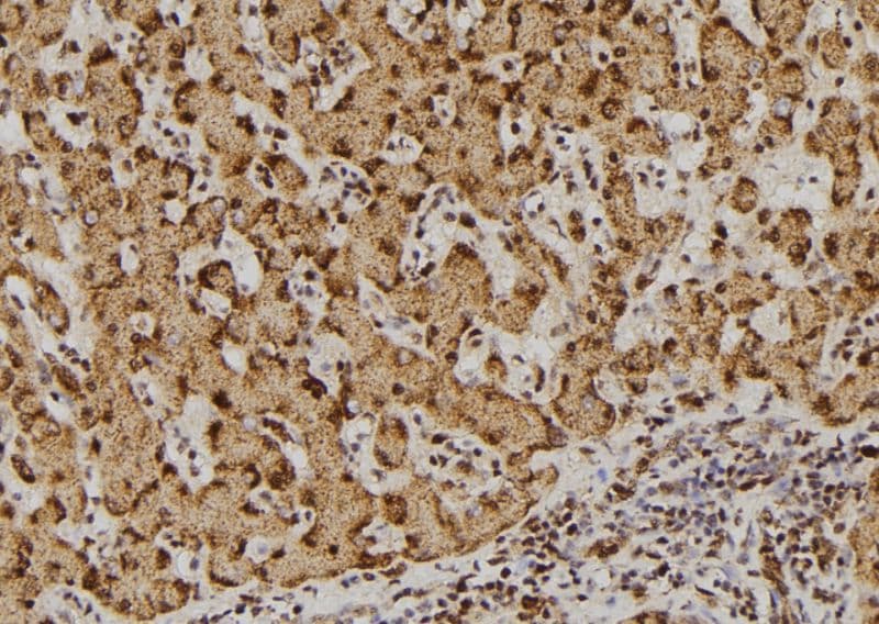 DDX3 / DDX3X Antibody