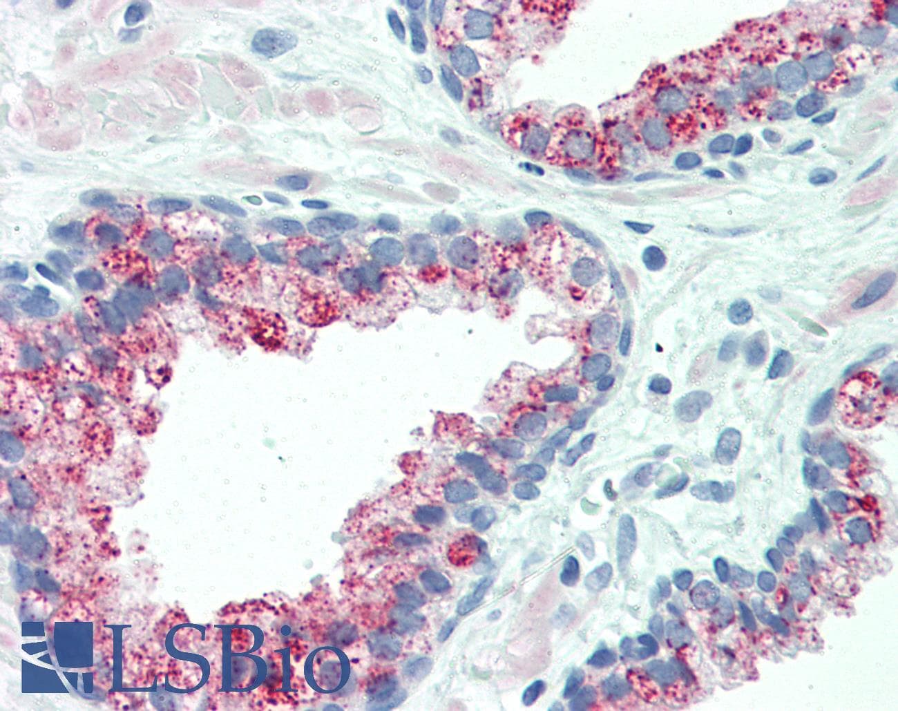 PathPlus™ SLC45A3 / Prostein / p501S Antibody