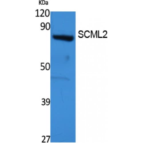 SCML2 Antibody (Internal)