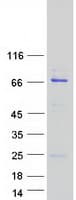 Human CKAP2 Protein (Recombinant Myc-DDK (Flag))