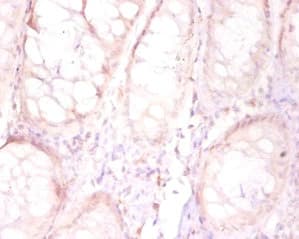 FAM110B / C8orf72 Antibody