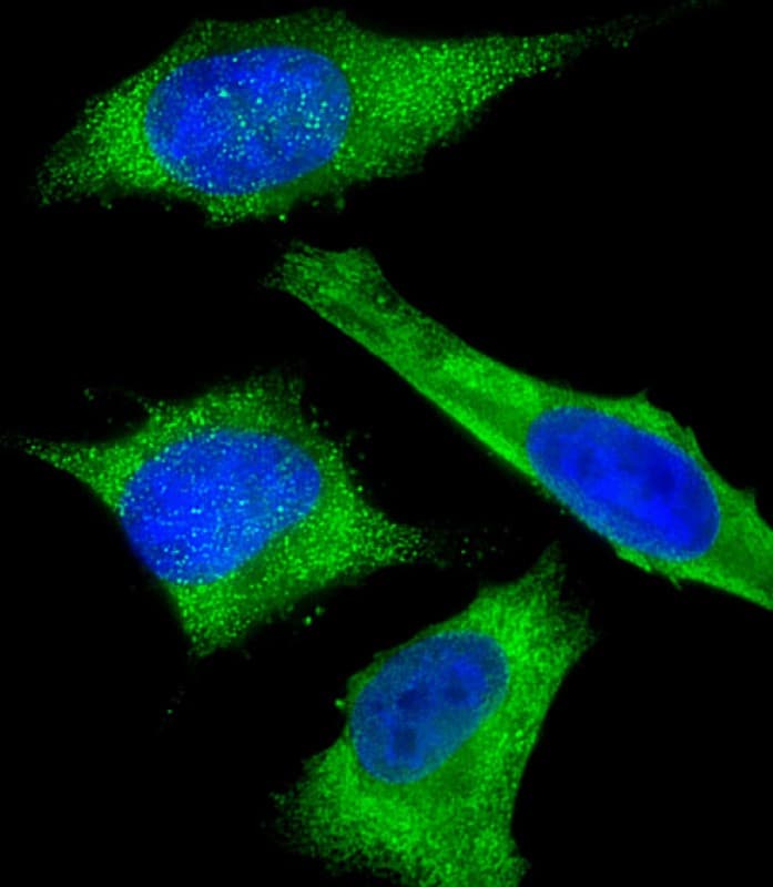 GAPDH Antibody (clone 1653CT401.3.33)