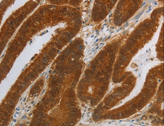 NIT2 Antibody