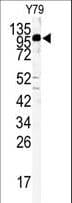 KIF3C Antibody (aa713-741)
