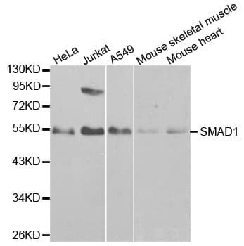 SMAD1 Antibody