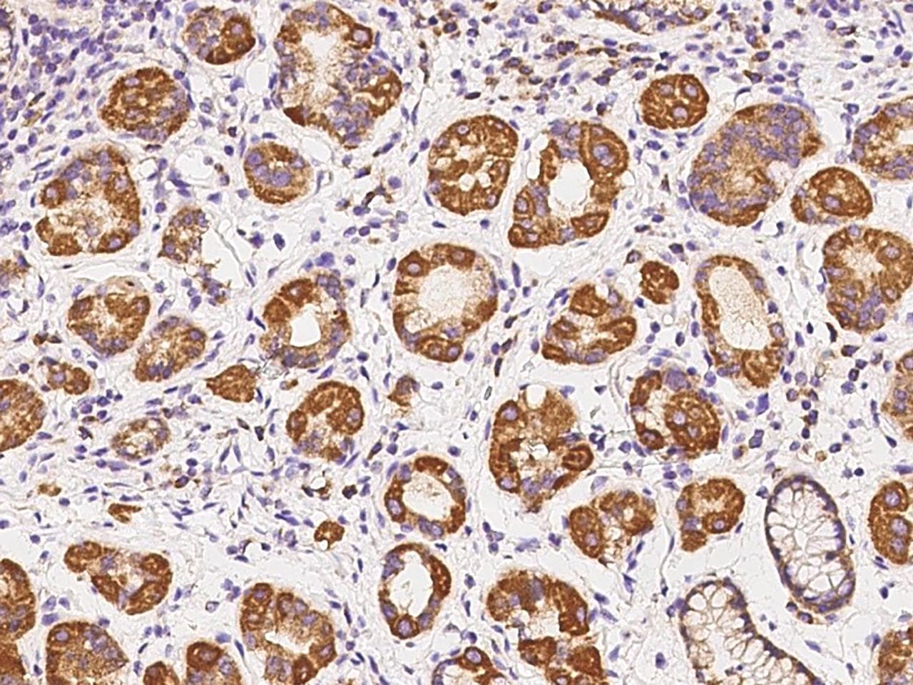 ABCC2 / MRP2 Antibody
