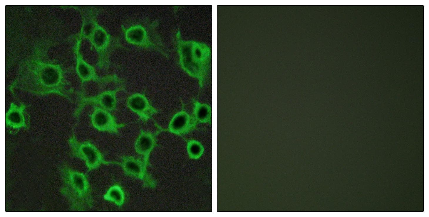 Polyclonal Rabbit anti-Human CCRL2 Antibody (IF, WB)
