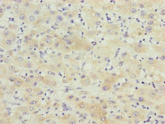 KCTD19 Antibody