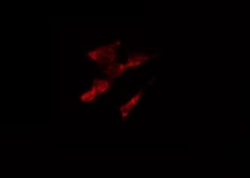 CASP7 / Caspase 7 Antibody