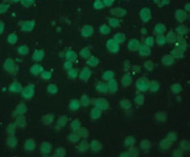 PORCN Antibody (aa224-239)