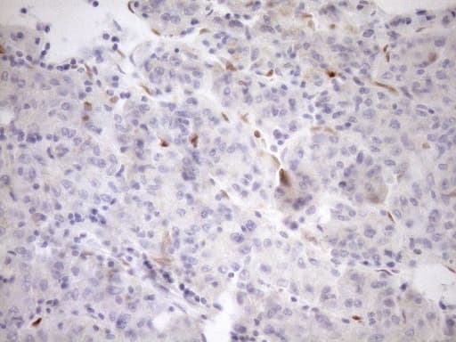 p16INK4a / CDKN2A Antibody (clone OTI1H3)