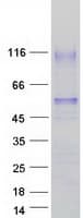 Human HAVCR1 / KIM-1 Protein (Recombinant Myc-DDK (Flag))
