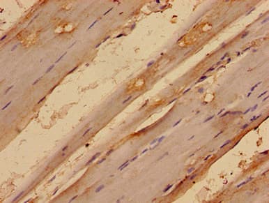 MED24 / TRAP100 Antibody