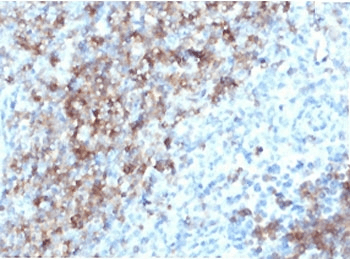 Monoclonal Mouse anti-Human CD3E Antibody (clone CDLA3e-1, IHC)