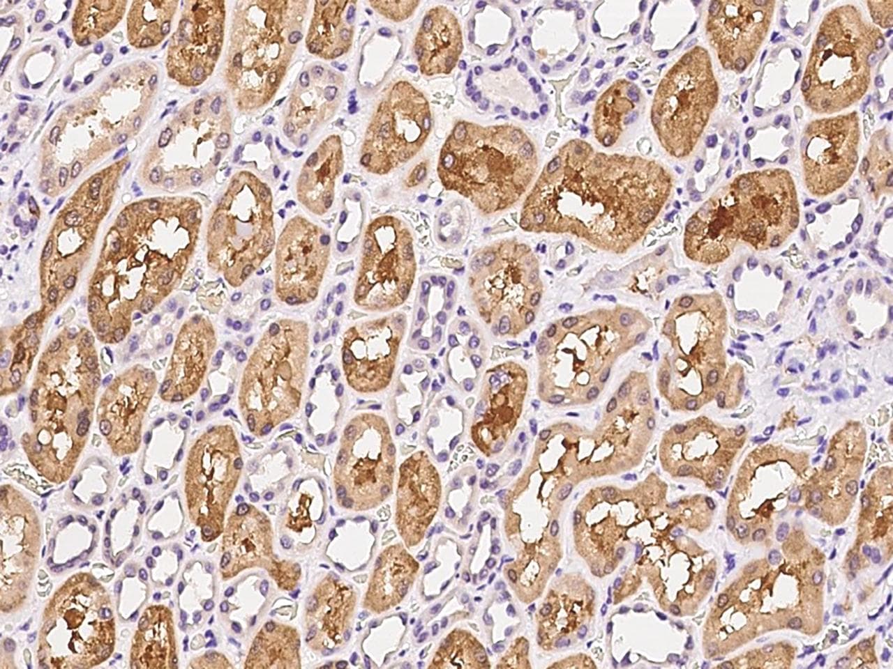 Polyclonal Rabbit anti-Human GPD1 Antibody (IHC)