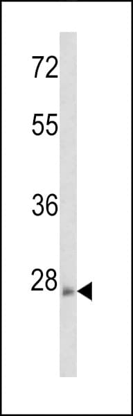 RHOE / RND3 Antibody (aa133-165)