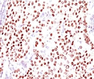 PR / Progesterone Receptor Antibody (clone PGSR17)